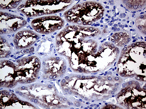 GALNT10 Antibody - Immunohistochemical staining of paraffin-embedded Human Kidney tissue within the normal limits using anti-GALNT10 mouse monoclonal antibody. (Heat-induced epitope retrieval by 1mM EDTA in 10mM Tris buffer. (pH8.5) at 120°C for 3 min. (1:500)