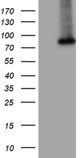 GALNT10 Antibody - HEK293T cells were transfected with the pCMV6-ENTRY control. (Left lane) or pCMV6-ENTRY GALNT10. (Right lane) cDNA for 48 hrs and lysed