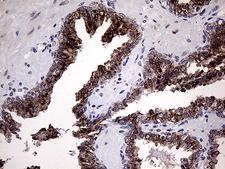 GALNT10 Antibody - Immunohistochemical staining of paraffin-embedded Human prostate tissue within the normal limits using anti-GALNT10 mouse monoclonal antibody. (Heat-induced epitope retrieval by 1mM EDTA in 10mM Tris buffer. (pH8.5) at 120°C for 3 min. (1:500)