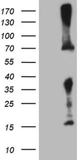 GALNT10 Antibody - HEK293T cells were transfected with the pCMV6-ENTRY control. (Left lane) or pCMV6-ENTRY GALNT10. (Right lane) cDNA for 48 hrs and lysed