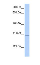 GALNT10 Antibody - Fetal liver lysate. Antibody concentration: 1.0 ug/ml. Gel concentration: 12%.  This image was taken for the unconjugated form of this product. Other forms have not been tested.