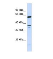 GALNT10 Antibody - Western blot of Human HeLa. GALNT10 antibody dilution 1.0 ug/ml.  This image was taken for the unconjugated form of this product. Other forms have not been tested.