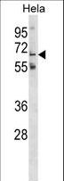GALNT11 Antibody - GLT11 Antibody western blot of HeLa cell line lysates (35 ug/lane). The GLT11 antibody detected the GLT11 protein (arrow).
