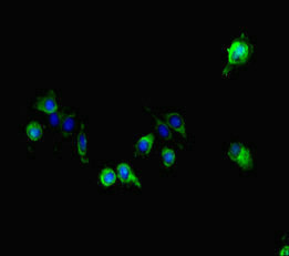 GALNT11 Antibody - Immunofluorescent analysis of HeLa cells diluted at 1:100 and Alexa Fluor 488-congugated AffiniPure Goat Anti-Rabbit IgG(H+L)