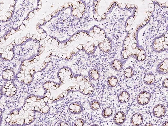 GALNT12 Antibody - Immunochemical staining of human GALNT12 in human large intestine with rabbit polyclonal antibody at 1:100 dilution, formalin-fixed paraffin embedded sections.