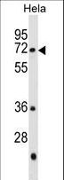 GALNT13 Antibody - GALNT13 Antibody western blot of HeLa cell line lysates (35 ug/lane). The GALNT13 antibody detected the GALNT13 protein (arrow).