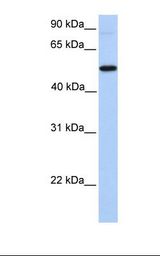 GALNT13 Antibody - Hela cell lysate. Antibody concentration: 1.0 ug/ml. Gel concentration: 12%.  This image was taken for the unconjugated form of this product. Other forms have not been tested.