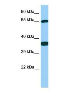 GALNT13 Antibody - Western blot of Galnt13 Antibody - C-terminal region in Rat Stomach cells lysate.  This image was taken for the unconjugated form of this product. Other forms have not been tested.