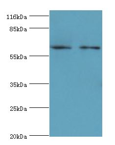 GALNT14 Antibody - Western blot. All lanes: Polypeptide N-acetylgalactosaminyltransferase 14 antibody at 2 ug/ml Lane 1:rat gonad tissue. Lane 2: mouse kidney tissue. Secondary antibody: Goat polyclonal to rabbit at 1:10000 dilution. Predicted band size: 64 kDa. Observed band size: 64 kDa.  This image was taken for the unconjugated form of this product. Other forms have not been tested.