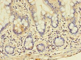 GALNT14 Antibody - Immunohistochemistry of paraffin-embedded human small intestine using antibody at 1:100 dilution.  This image was taken for the unconjugated form of this product. Other forms have not been tested.