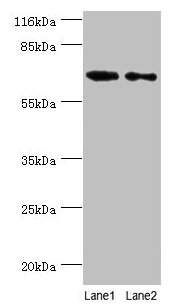 GALNT14 Antibody - Western blot All lanes: Polypeptide N-acetylgalactosaminyltransferase 14 antibody at 2µg/ml Lane 1: Rat gonad tissue Lane 2: Mouse kidney tissue Secondary Goat polyclonal to rabbit IgG at 1/10000 dilution Predicted band size: 65, 61, 62 kDa Observed band size: 65 kDa