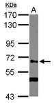 GALNT14 Antibody - Sample (30 ug of whole cell lysate) A: NT2D1 7.5% SDS PAGE GALNT14 antibody diluted at 1:1000