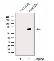 GALNT14 Antibody - Western blot analysis of extracts of mouse kidney tissue using GALNT14 antibody. The lane on the left was treated with blocking peptide.