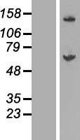 GALNT14 Protein - Western validation with an anti-DDK antibody * L: Control HEK293 lysate R: Over-expression lysate