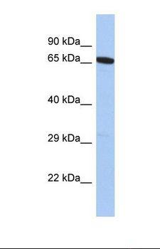 GALNT15 / GALNTL2 Antibody - Western blot of Human PANC1. GALNT15 antibody dilution 1.0 ug/ml.  This image was taken for the unconjugated form of this product. Other forms have not been tested.