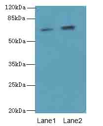 GALNT15 / GALNTL2 Antibody - Western blot. All lanes: GALNT15 antibody at 5 ug/ml. Lane 1: Mouse kidney tissue. Lane 2: Mouse liver tissue. Secondary Goat polyclonal to Rabbit IgG at 1:10000 dilution. Predicted band size: 73 kDa. Observed band size: 73 kDa.