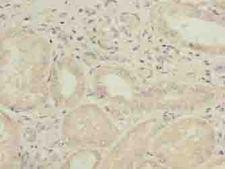 GALNT15 / GALNTL2 Antibody - Immunohistochemistry of paraffin-embedded human kidney tissue using antibody at dilution of 1:100.