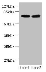 GALNT15 / GALNTL2 Antibody - Western blot All lanes: GALNT15 antibody at 5µg/ml Lane 1: Mouse kidney tissue Lane 2: Mouse liver tissue Secondary Goat polyclonal to rabbit IgG at 1/10000 dilution Predicted band size: 73 kDa Observed band size: 73 kDa