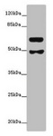 GALNT16 / GALNTL1 Antibody - Western blot All lanes: GALNT16 antibody at 12µg/ml + Mouse kidney tissue Secondary Goat polyclonal to rabbit IgG at 1/10000 dilution Predicted band size: 64, 61 kDa Observed band size: 64, 49 kDa