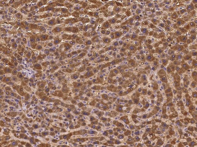 GALNT18 / GALNTL4 Antibody - Immunochemical staining of human GALNT18 in human liver with rabbit polyclonal antibody at 1:500 dilution, formalin-fixed paraffin embedded sections.