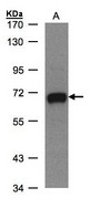 GALNT2 Antibody - Sample (30 ug whole cell lysate). A: MOLT4 . 7.5% SDS PAGE. GALNT2 antibody diluted at 1:500