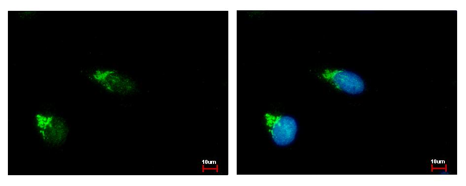 GALNT2 Antibody - GALNT2 antibody [N1C1] detects GALNT2 protein at Golgi apparatus by immunofluorescent analysis. HeLa cells were fixed in ice-cold MeOH for 5 min. GALNT2 protein stained by GALNT2 antibody [N1C1] diluted at 1:500. 