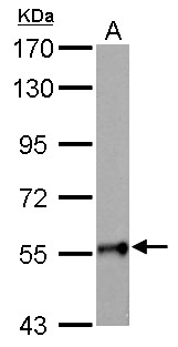 GALNT2 Antibody - GALNT2 antibody detects GALNT2 protein by Western blot analysis. A. 50 ug rat brain lysate/extract. 7.5 % SDS-PAGE. GALNT2 antibody dilution:1:1000