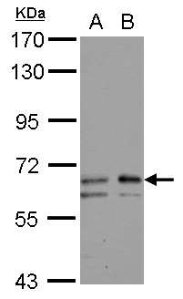 GALNT2 Antibody - Sample (30 ug of whole cell lysate) A: NT2D1 B: IMR32 7.5% SDS PAGE GALNT2 antibody diluted at 1:1000