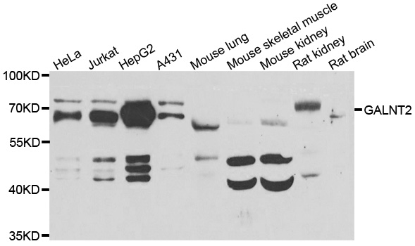 GALNT2 Antibody - Western blot analysis of extracts of various cell lines.