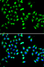 GALNT2 Antibody - Immunofluorescence analysis of HeLa cells.