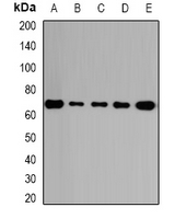 GALNT2 Antibody - Western blot analysis of GalNAc-T2 expression in HepG2 (A); A431 (B); mouse lung (C); rat kidney (D); rat brain (E) whole cell lysates.