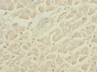 GALNT2 Antibody - Immunohistochemistry of paraffin-embedded human heart tissue at dilution 1:100