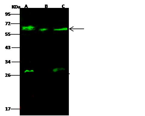 GALNT2 Antibody - Anti-GALNT2 rabbit polyclonal antibody at 1:500 dilution. Lane A: A549 Whole Cell Lysate. Lane B: Hela Whole Cell Lysate. Lane C: U87MG Whole Cell Lysate. Lysates/proteins at 30 ug per lane. Secondary: Goat Anti-Rabbit IgG H&L (Dylight 800) at 1/10000 dilution. Developed using the Odyssey technique. Performed under reducing conditions. Predicted band size: 65 kDa. Observed band size: 65 kDa. (We are unsure as to the identity of these extra bands.)