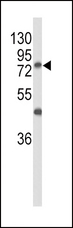 GALNT3 Antibody - Western blot of GALNT3 Antibody in MCF-7 cell line lysates (35 ug/lane). GALNT3 (arrow) was detected using the purified antibody.