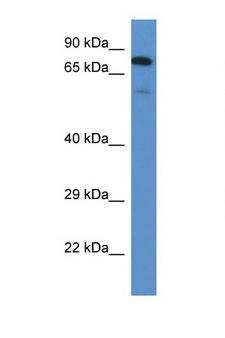 GALNT3 Antibody - GALNT3 antibody Western blot of Rat Brain lysate. Antibody concentration 1 ug/ml. This image was taken for the unconjugated form of this product. Other forms have not been tested.