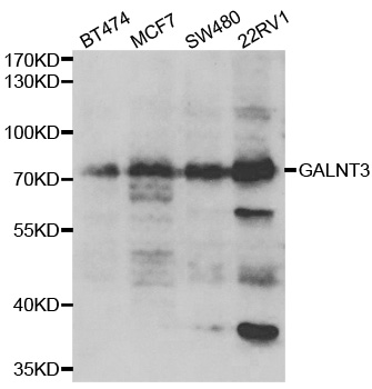 GALNT3 Antibody - Western blot analysis of extracts of various cell lines.