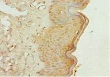 GALNT3 Antibody - Immunohistochemistry of paraffin-embedded human skin tissue at dilution 1:100