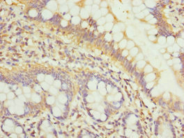 GALNT3 Antibody - Immunohistochemistry of paraffin-embedded human small intestine tissue at dilution 1:100