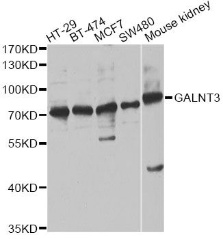 GALNT3 Antibody - Western blot analysis of extracts of various cell lines, using GALNT3 antibody at 1:1000 dilution. The secondary antibody used was an HRP Goat Anti-Rabbit IgG (H+L) at 1:10000 dilution. Lysates were loaded 25ug per lane and 3% nonfat dry milk in TBST was used for blocking. An ECL Kit was used for detection and the exposure time was 30s.