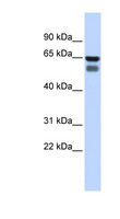 GALNT4 Antibody - GALNT4 antibody Western blot of Fetal Stomach lysate. This image was taken for the unconjugated form of this product. Other forms have not been tested.