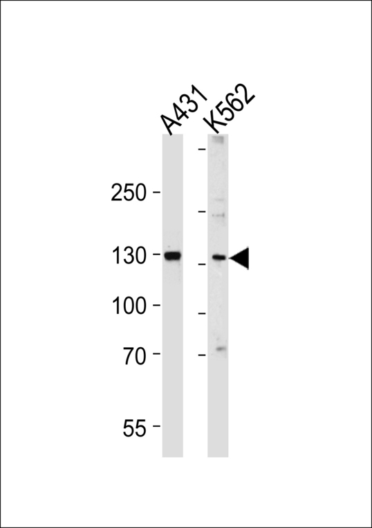 GALNT5 Antibody - Western blot of lysates from A431, K562 cell line (from left to right), using GALNT5 Antibody. Antibody was diluted at 1:1000 at each lane. A goat anti-rabbit IgG H&L (HRP) at 1:5000 dilution was used as the secondary antibody. Lysates at 35ug per lane.