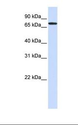 GALNT6 Antibody - 293T cell lysate. Antibody concentration: 1.0 ug/ml. Gel concentration: 12%.  This image was taken for the unconjugated form of this product. Other forms have not been tested.