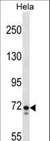 GALNT6 Antibody - GALNT6 Antibody western blot of HeLa cell line lysates (35 ug/lane). The GALNT6 antibody detected the GALNT6 protein (arrow).