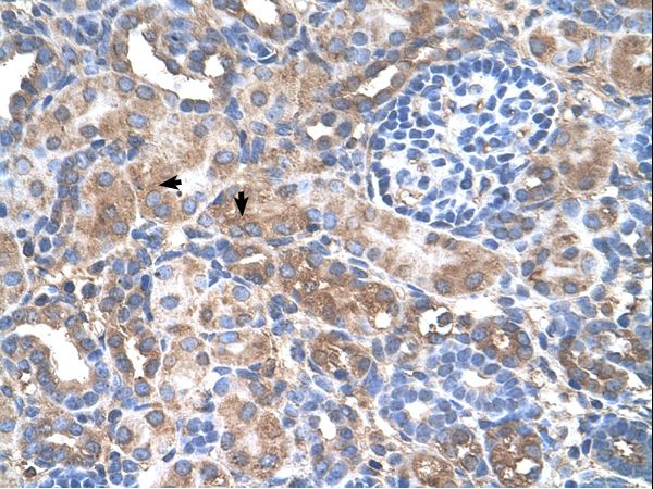 GALNT6 Antibody - GALNT6 antibody GALNT6(UDP-N-acetyl-alpha-D-galactosamine:polypeptide N-acetylgalactosaminyltransferase 6) Antibody was used in IHC to stain formalin-fixed, paraffin-embedded human kidney.  This image was taken for the unconjugated form of this product. Other forms have not been tested.