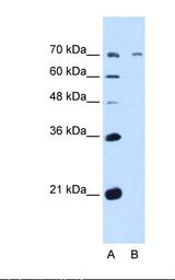 GALNT6 Antibody - Lane A: HepG2 cell lysate. Antibody concentration: 5.0 ug/ml. Gel concentration: 12%.  This image was taken for the unconjugated form of this product. Other forms have not been tested.
