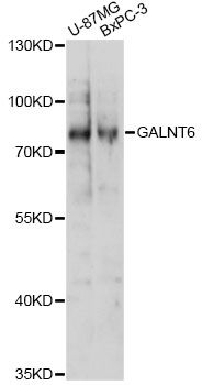 GALNT6 Antibody - Western blot analysis of extracts of various cell lines, using GALNT6 antibody at 1:1000 dilution. The secondary antibody used was an HRP Goat Anti-Rabbit IgG (H+L) at 1:10000 dilution. Lysates were loaded 25ug per lane and 3% nonfat dry milk in TBST was used for blocking. An ECL Kit was used for detection and the exposure time was 1s.