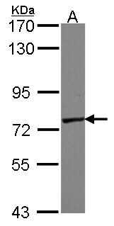 GALNT7 Antibody - Sample (30 ug of whole cell lysate). A: A431 . 7.5% SDS PAGE. GALNT7 antibody diluted at 1:10000.