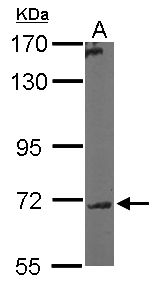 GALNT7 Antibody - Sample (50 ug of whole cell lysate). A: Mouse brain. 7.5% SDS PAGE. GALNT7 antibody diluted at 1:5000.
