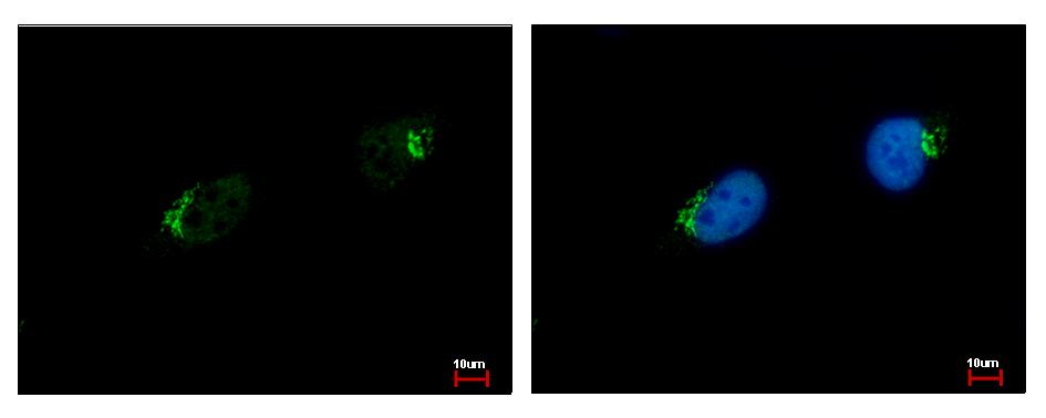 GALNT7 Antibody - GALNT7 antibody [N1C2] detects GALNT7 protein at Golgi apparatus by immunofluorescent analysis. HeLa cells were fixed in 4% paraformaldehyde at RT for 15 min. GALNT7 protein stained by GALNT7 antibody [N1C2] diluted at 1:500. 