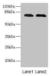GALNT7 Antibody - Western blot All lanes: GALNT7 antibody at 0.1µg/ml Lane 1: Hela whole cell lysate Lane 2: HepG2 whole cell lysate Secondary Goat polyclonal to rabbit IgG at 1/10000 dilution Predicted band size: 75 kDa Observed band size: 75 kDa